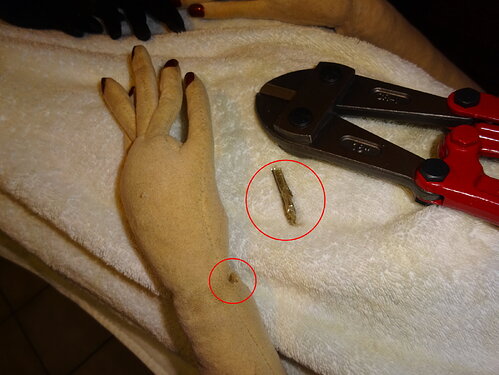 Anette_Surgery_20231228_02