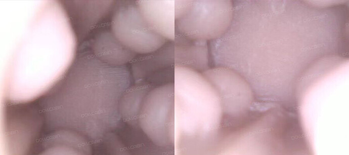 inside-the-vaginal