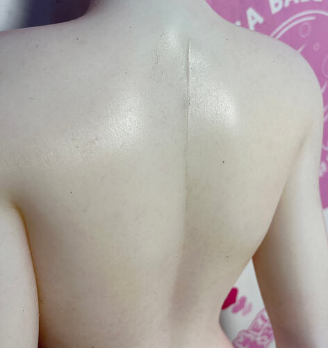 Repaired frame damage on the back-背部有修复骨架受损的痕迹