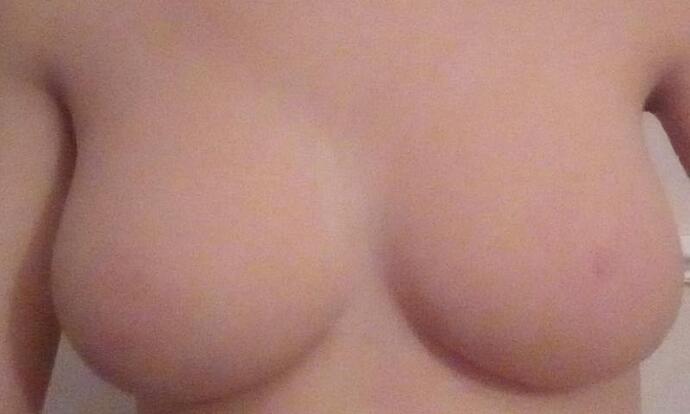 78867