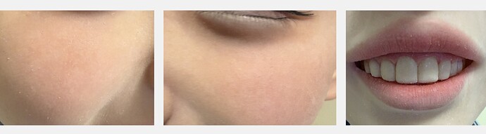 018 - Rosy Cheeks + Smile