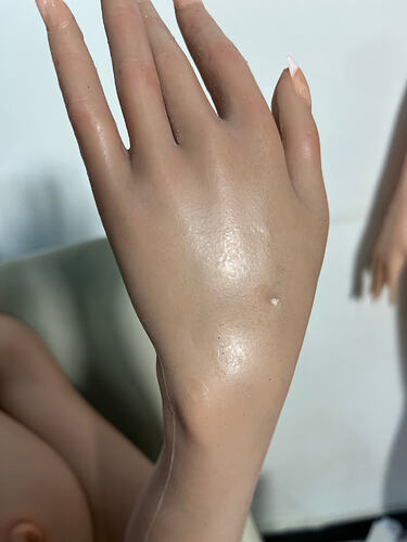 Pits on hand backs-手背有坑洞
