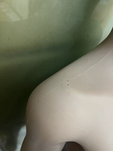 Air pinholes and indentations on shoulders-肩部有气泡空洞和坑洼