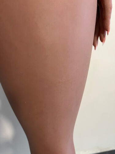 Scratches on leg 腿部抓痕