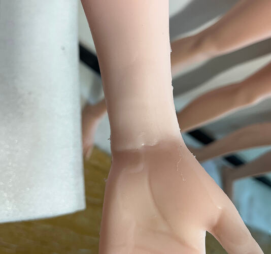 Peeling on palms-手掌掉皮