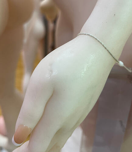 Indentations on hands-手部有坑洼