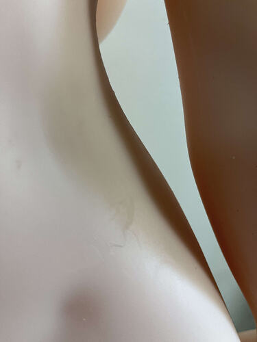 Skin peeling on upper hip area 臀部上方掉皮