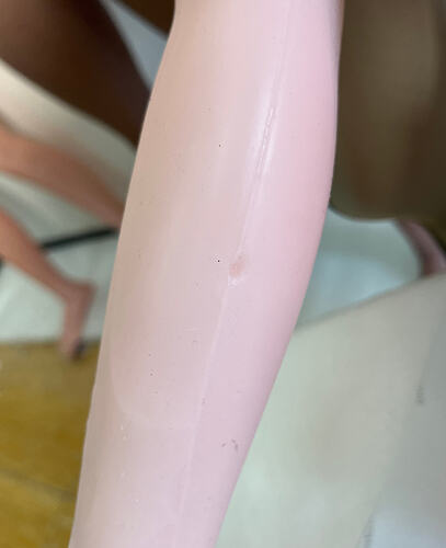 Indentation on the arm-手臂凹坑