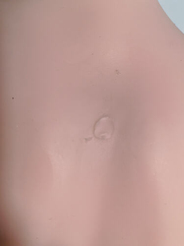 Back hole 后背坑洞