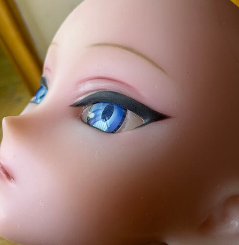 Pits around the eyes-眼周瑕疵